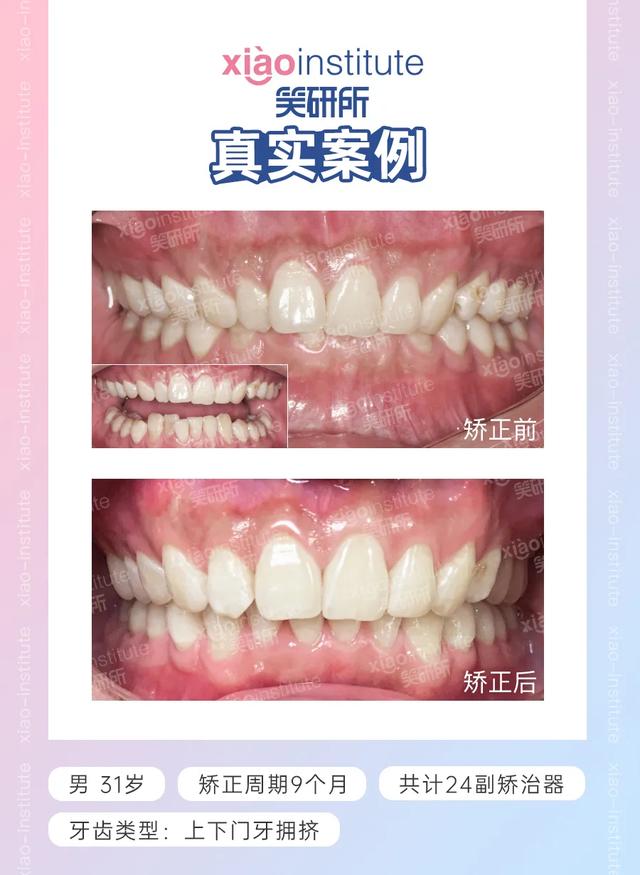 ʮqw(yn)ʮ