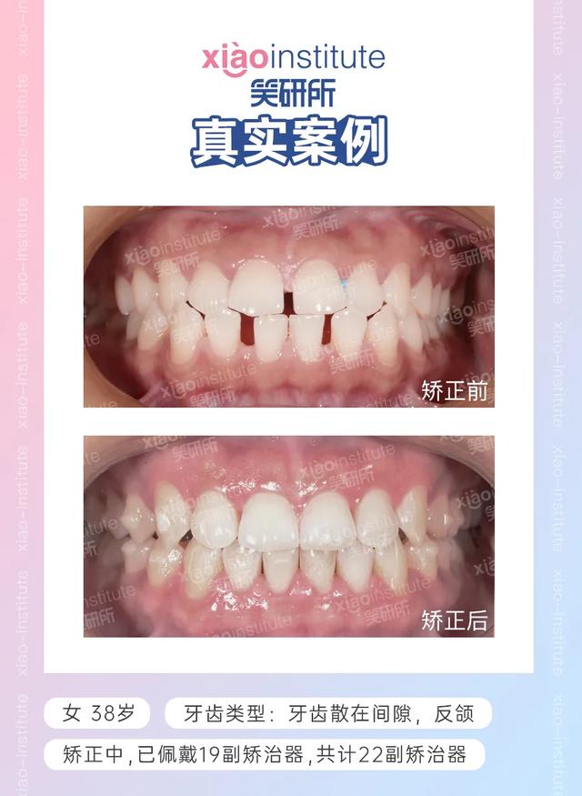 ʮqw(yn)ʮ